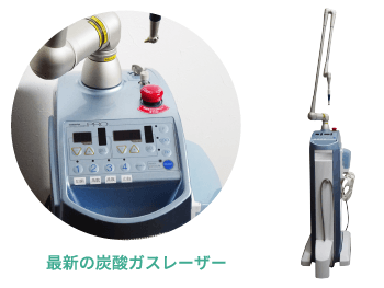 最新の炭酸ガスレーザー